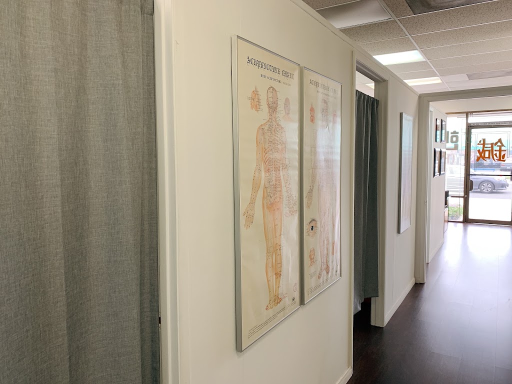 JI Acupuncture Clinic | 509 S Euclid St, Anaheim, CA 92802, USA | Phone: (714) 772-9227