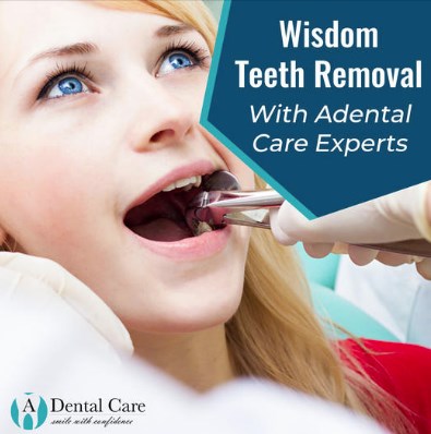 A Dental Care | 6888 Gulf Fwy, Houston, TX 77087, United States | Phone: (832) 990-2874