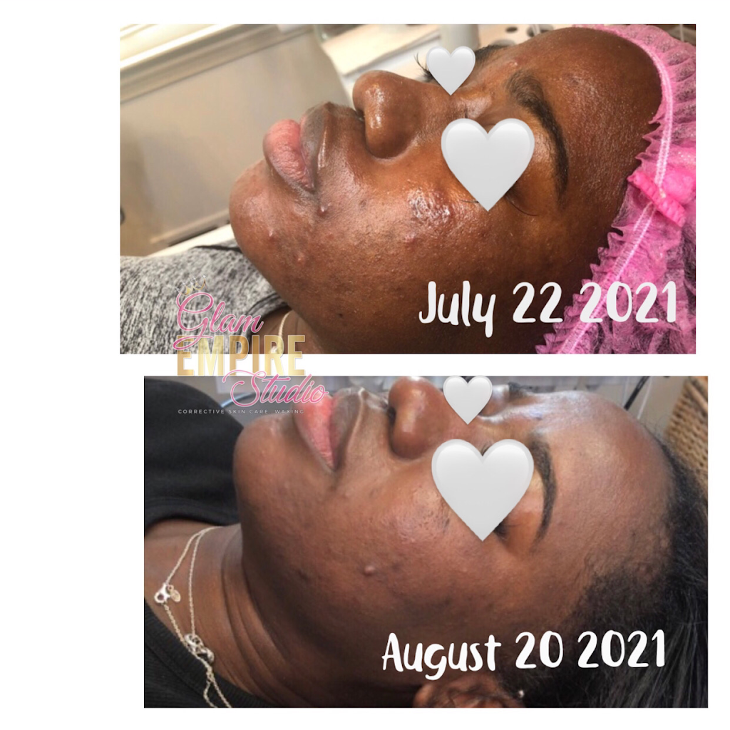 Glam Empire Studio LLC- Corrective Skin Care & Waxing | 213 Old Padonia Rd #2, Cockeysville, MD 21030, USA | Phone: (443) 826-0846