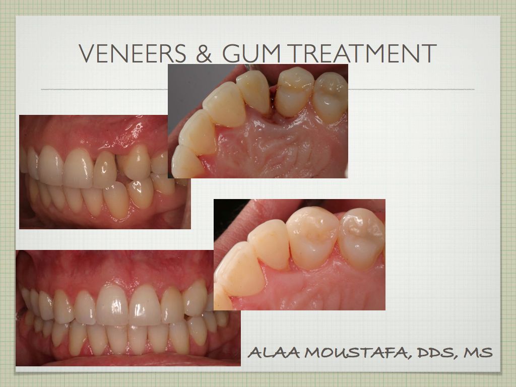 Alaa Moustafa, DDS, MS | 47 Penny Ln, Watsonville, CA 95076, USA | Phone: (831) 724-4539