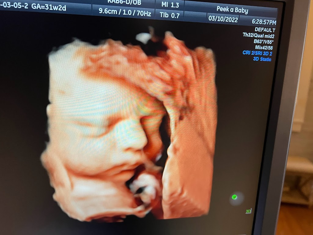 The Peek A Baby 3/4D Ultrasound Boutique | 230 Harrison Ave, Harrison, OH 45030 | Phone: (513) 845-4005