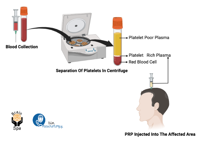 BOTOX Clinic | PRP for Hair Loss | 3600 North Star Road #140, Richardson, TX 75082 | Phone: (469) 493-1964