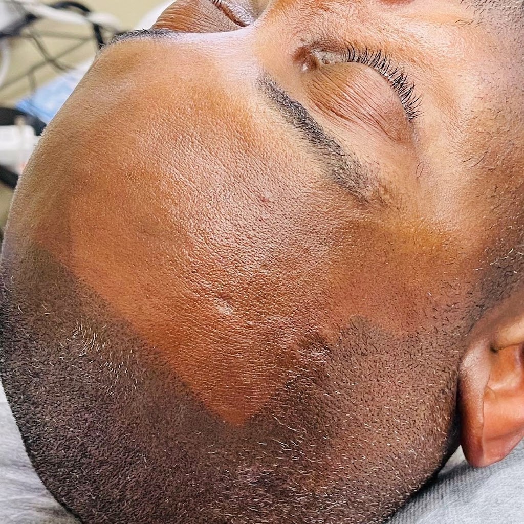 Paramedical Pigments Beauty Co. - Scalp Micropigmentation studio & Day Spa | second floor, 1329 E Kemper Rd Suite 4218 F, Cincinnati, OH 45246 | Phone: (513) 641-8516