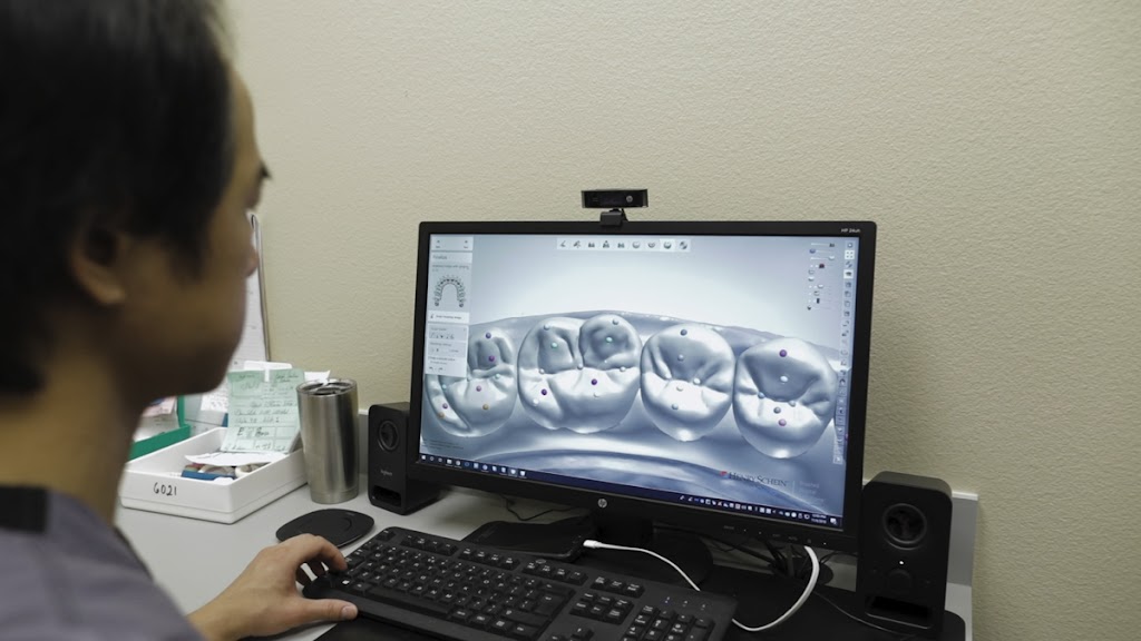 XircOn Dental Designers | 1235 Kinwest Pkwy Suite 130, Irving, TX 75063, USA | Phone: (469) 957-0702