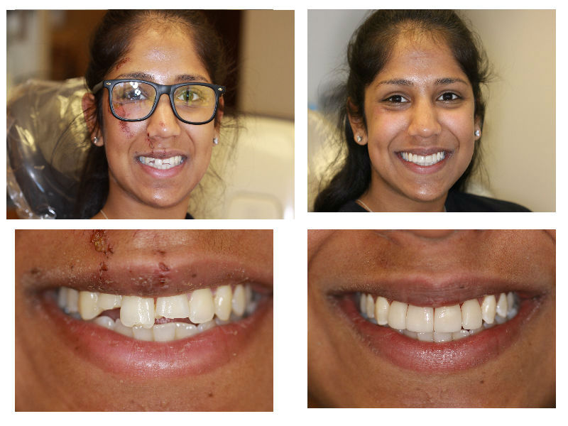 FC dental-Fairfax (Michael Song DDS, PC) | 3975 Fair Ridge Dr #301n, Fairfax, VA 22033, USA | Phone: (703) 385-5455