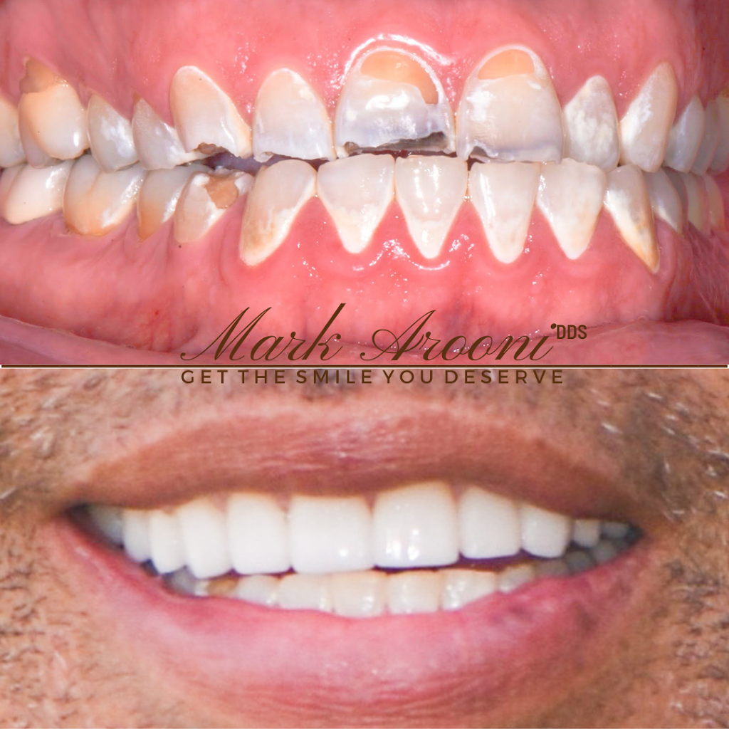 Mark Arooni DDS | 1949 W Ray Rd UNIT 26, Chandler, AZ 85224, USA | Phone: (480) 485-0549