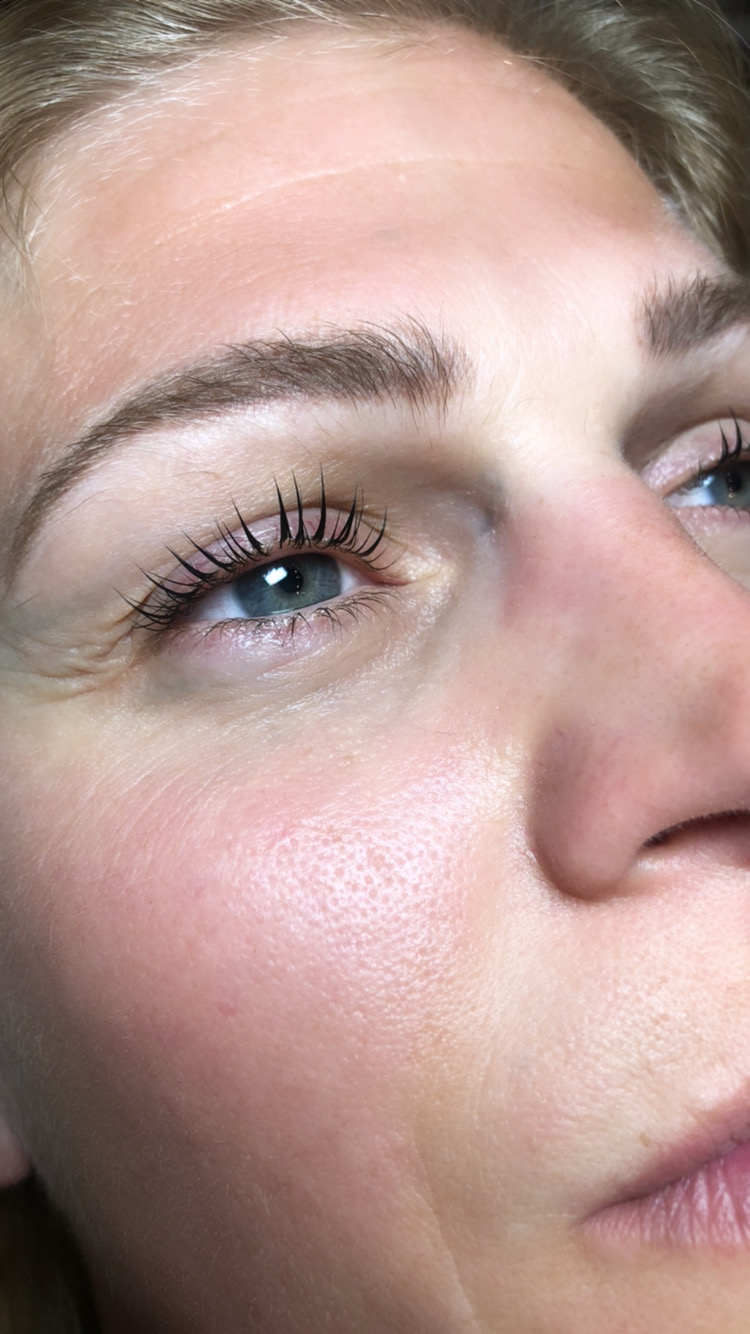 Sugar and Skin Aesthetics | 560 N Coast Hwy 101 #2a, Encinitas, CA 92024, USA | Phone: (831) 262-0128