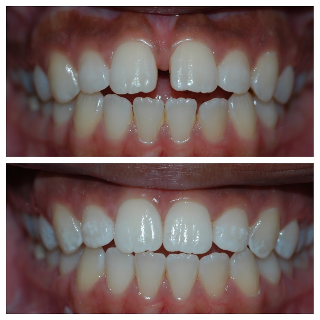 Bright Smiles Cosmetic & Implant Dentistry | 1444 Kempsville Rd #101, Virginia Beach, VA 23464, USA | Phone: (757) 497-8611