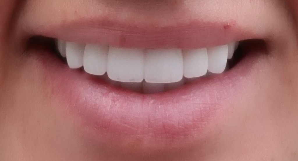 Albany Smiles - Andrew T. Frank, DMD | 1816 Western Ave, Albany, NY 12203, USA | Phone: (518) 456-3551