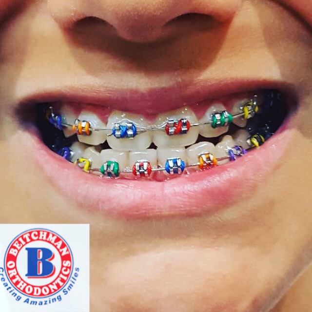 Beitchman Orthodontics | 25 FM 3351 S, Boerne, TX 78006, USA | Phone: (830) 229-5444