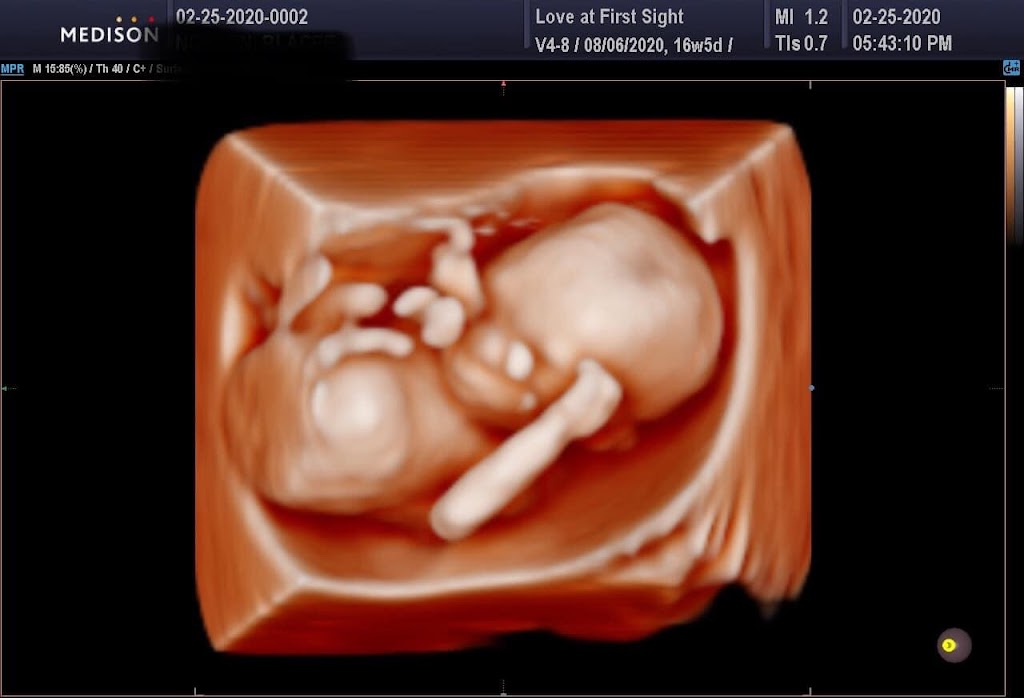 Love At First Sight 3D/4D HD Ultrasound | 3321 Colorado Blvd, Denton, TX 76210, USA | Phone: (940) 727-1272