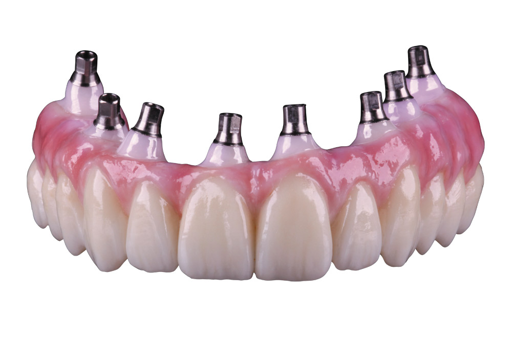 3D Dental Lab Inc | 2427 Baker Dr suite a, Mesquite, TX 75150, USA | Phone: (972) 270-9995