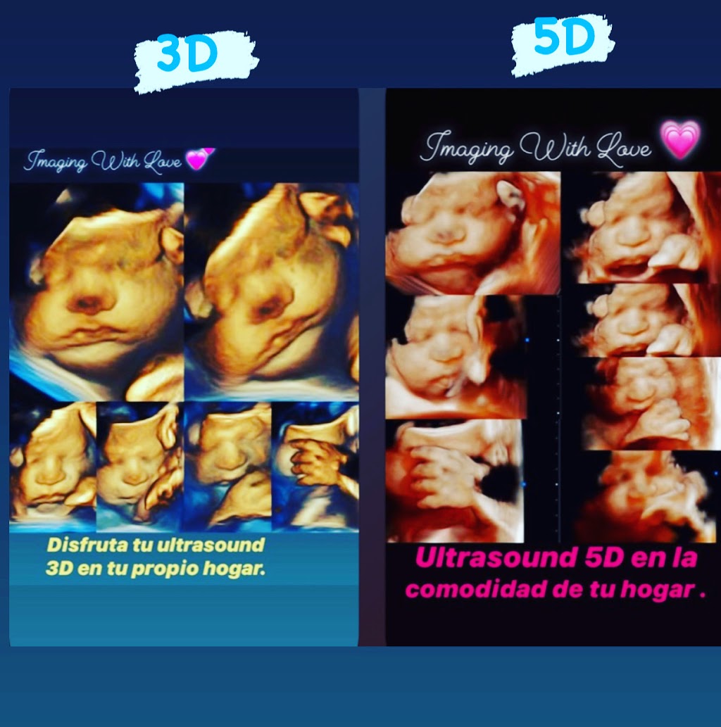 Imaging With Love | 8268 Sw 157th Ct Mobile, 3D/4D and 5D Ultrasound,en el comfort de Tu Propio hogar, Miami, FL 33193, USA | Phone: (786) 325-8006