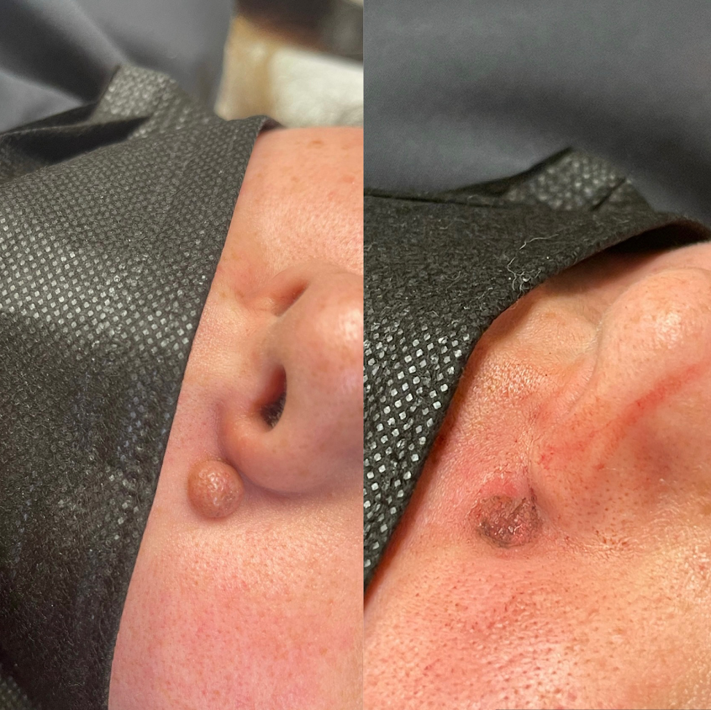 Bellatudo Skin and Wellness Center | 12721 Newport Ave Suite 2, Tustin, CA 92780, USA | Phone: (714) 852-3128