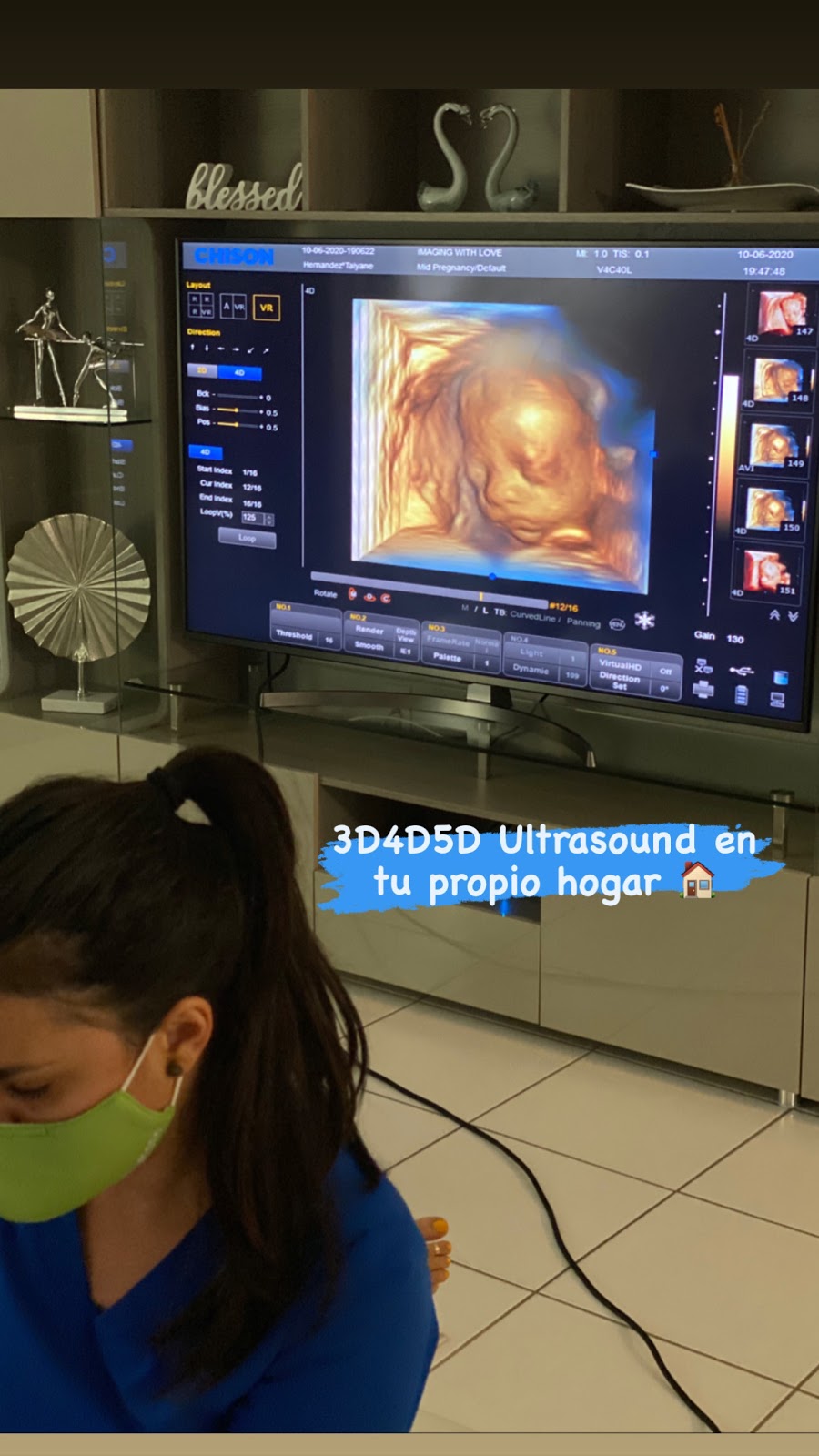 Imaging With Love | 8268 Sw 157th Ct Mobile, 3D/4D and 5D Ultrasound,en el comfort de Tu Propio hogar, Miami, FL 33193, USA | Phone: (786) 325-8006