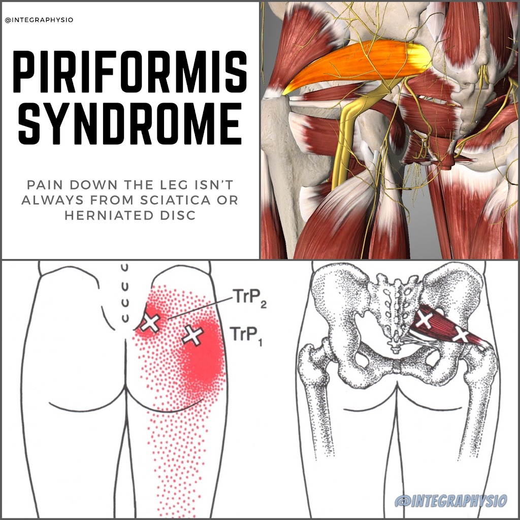 Limitless Physiotherapy: One-on-One Physical Therapy / Dry Needling | 9192 Red Branch Rd Suite 120, Columbia, MD 21045 | Phone: (443) 545-7171