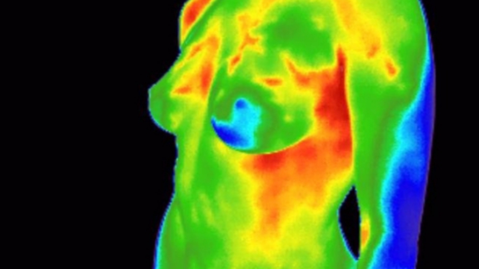 DFW Thermography, Inc | 2300 Valley View Ln Suite #865, Irving, TX 75062, USA | Phone: (469) 333-0623