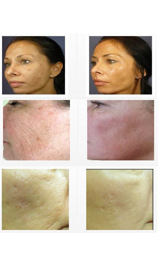 Angels Skin Care | 5919 Farralone Ave, Woodland Hills, CA 91367, USA | Phone: (818) 489-6613