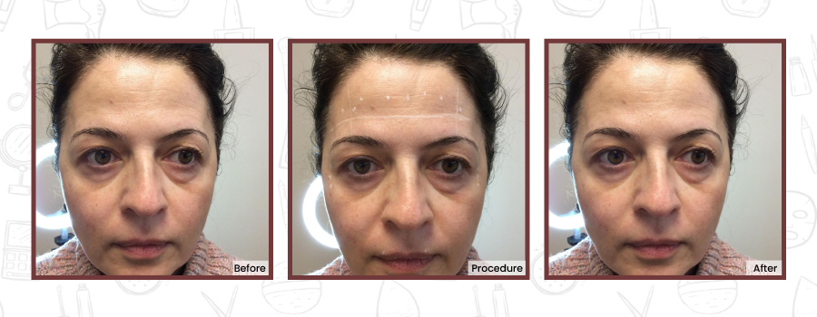 Blissful Me MedSpa | 345 N Main St #3, New City, NY 10956, USA | Phone: (845) 708-5188