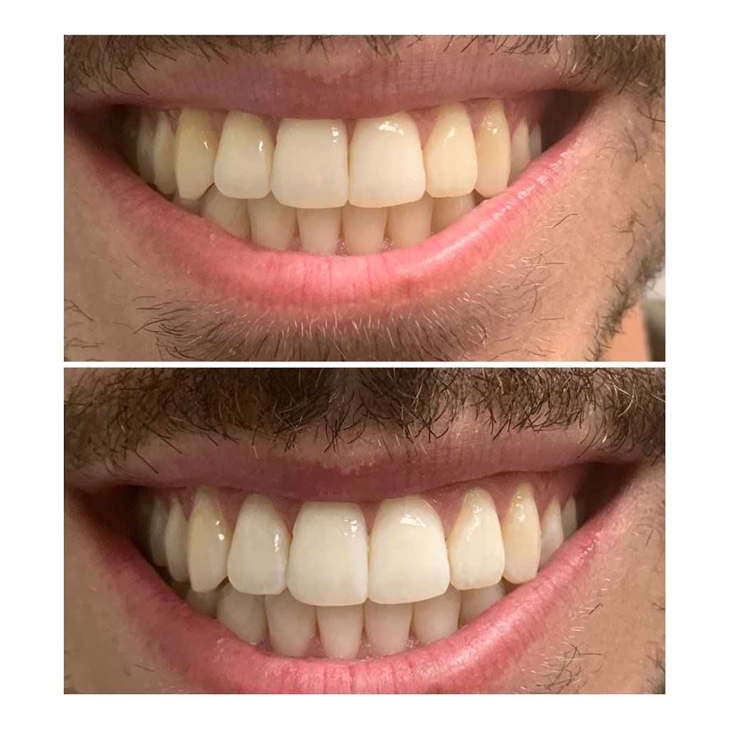 Smile Spa Teeth Whitening | 143 E Germann Rd building 101 suite 404, Gilbert, AZ 85297, USA | Phone: (480) 925-4050