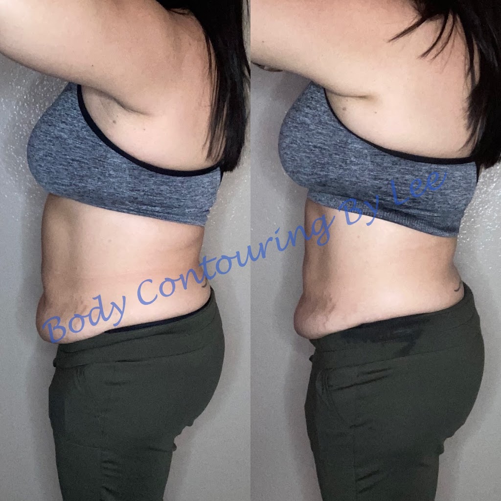 Body Contouring By Lee | Parking lot, 1547 E Broadway Rd, Mesa, AZ 85204 | Phone: (602) 693-4341