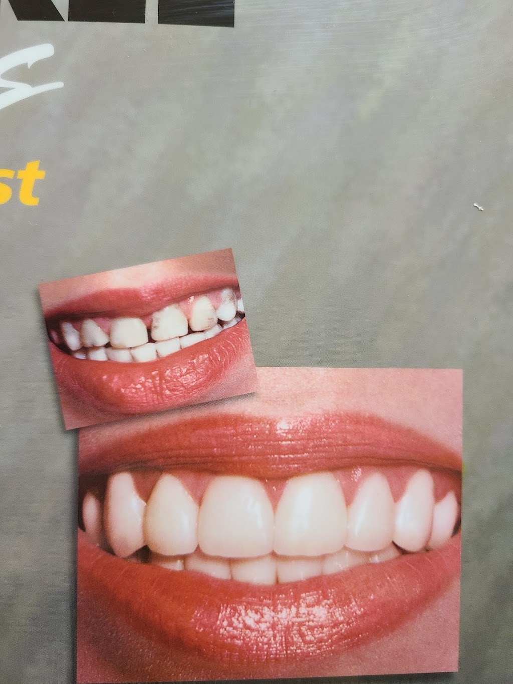 Dr. David Chou, DDS | 1206 N Hacienda Blvd, La Puente, CA 91744, USA | Phone: (626) 917-8630 Dr. David Chou, DDS | 1206 N Hacienda Blvd, La Puente, CA 91744, USA | Phone: (626) 917-8630