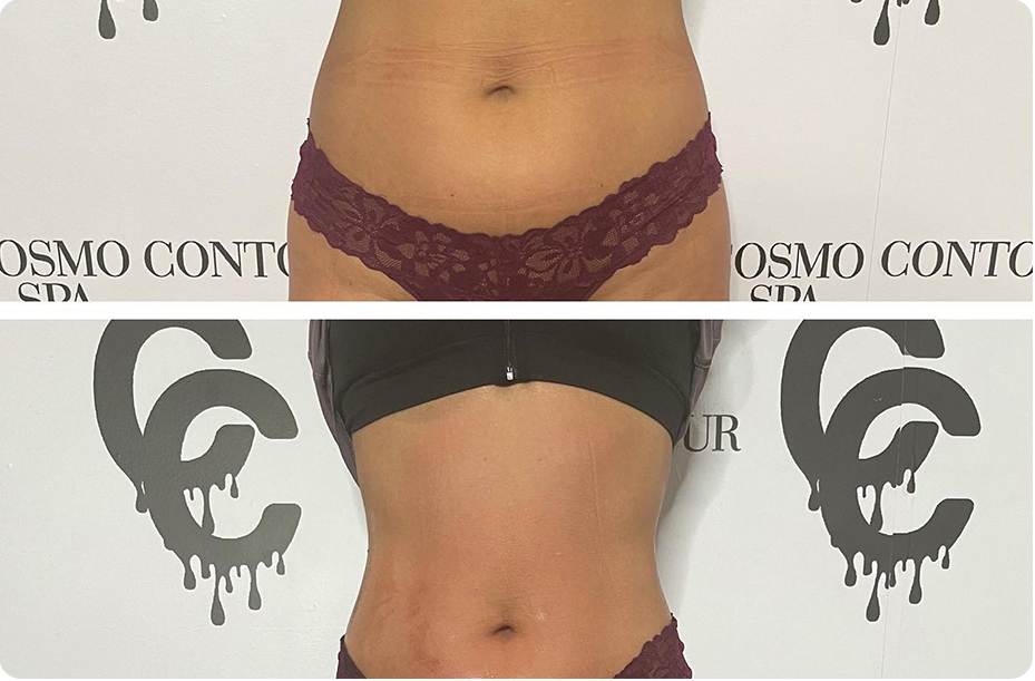 Cosmo Contour & Spa | 7129-7131 Owensmouth Ave Suite 2, Canoga Park, CA 91303, USA | Phone: (818) 330-5220