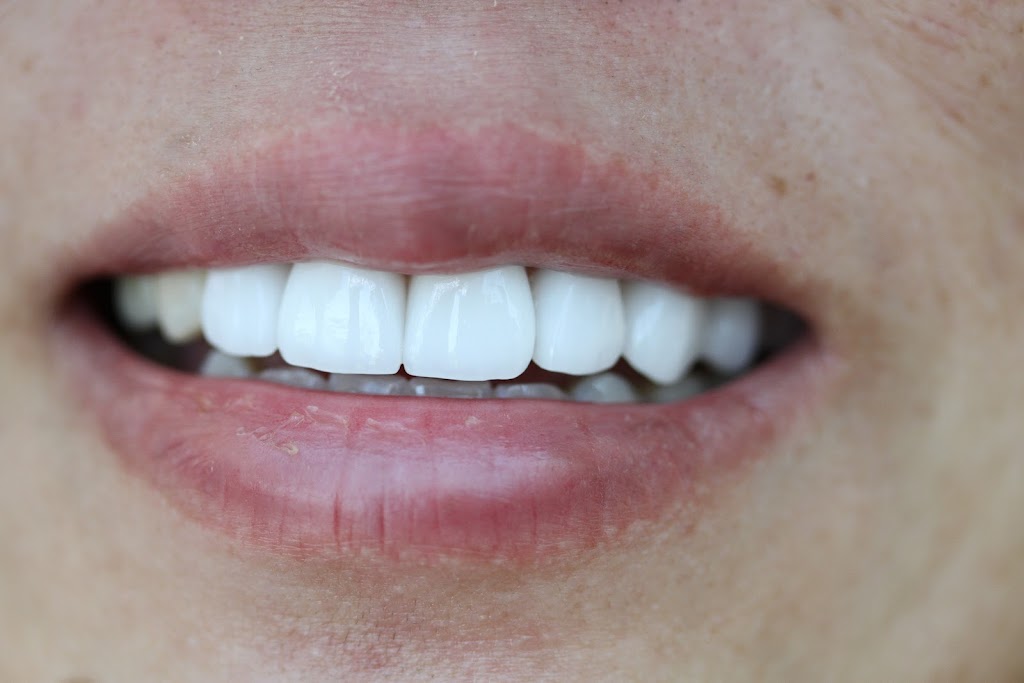 Smiles By Eddie | 6342 Fallbrook Ave STE 202, Woodland Hills, CA 91367, USA | Phone: (818) 883-2173