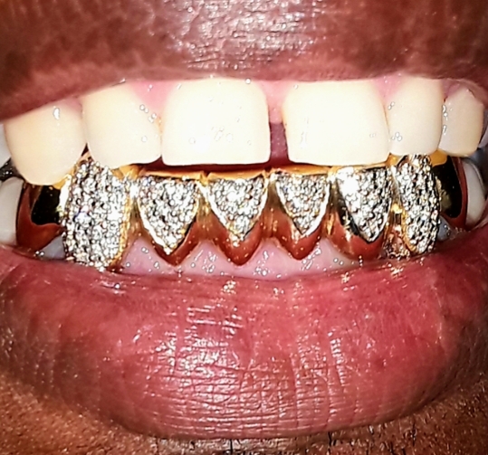 WG Gold Grillz | 10300 SW 72nd St # 280, Miami, FL 33173 | Phone: (786) 712-9299