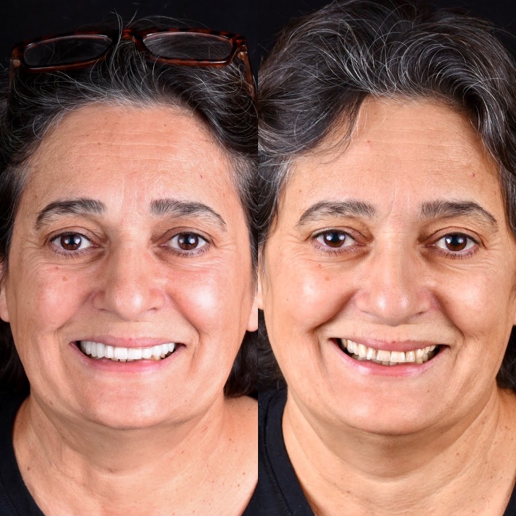 Modern Smiles | 10545 Victory Blvd, North Hollywood, CA 91606, USA | Phone: (818) 763-9353