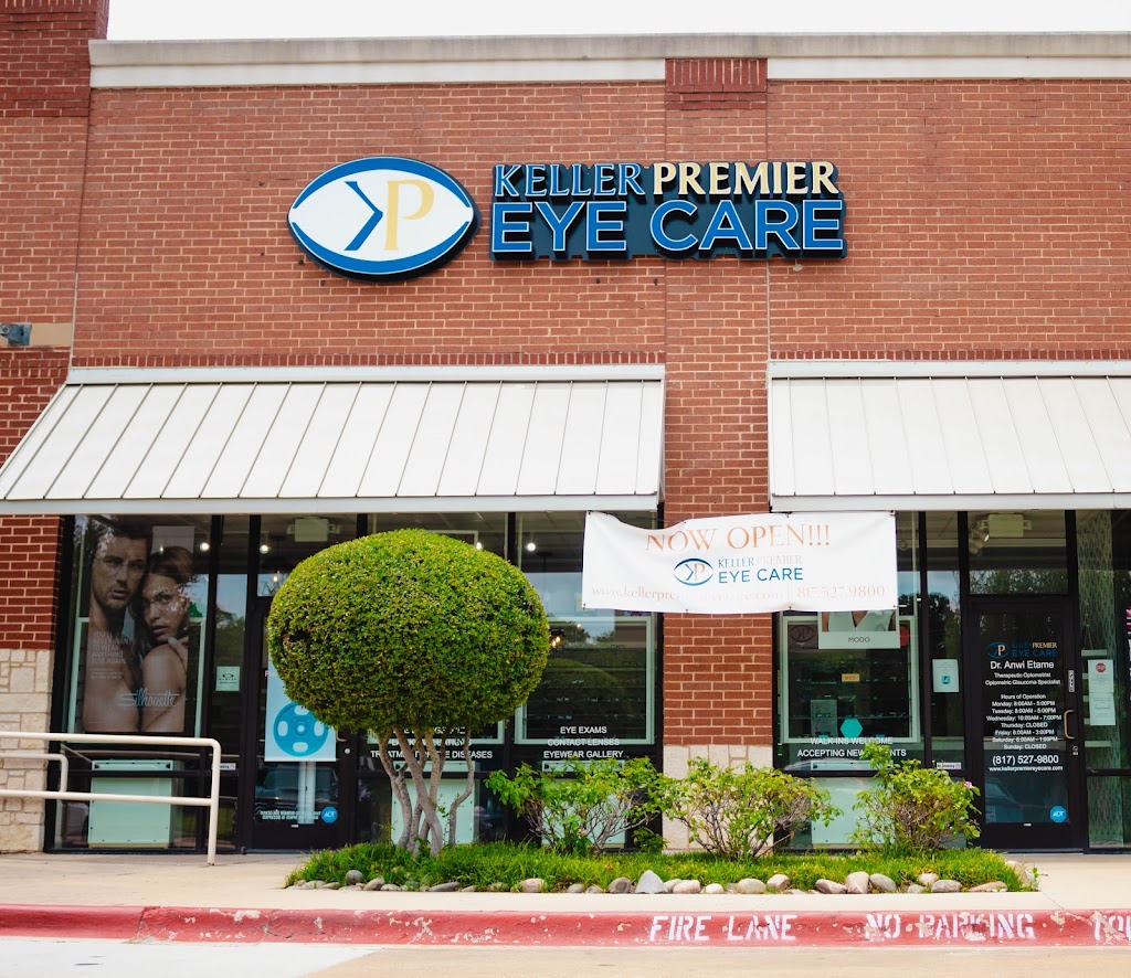 Keller Premier Eye Care: Anwi Etame, OD | 900 S Main St Suite #351, Keller, TX 76248, USA | Phone: (817) 527-9800