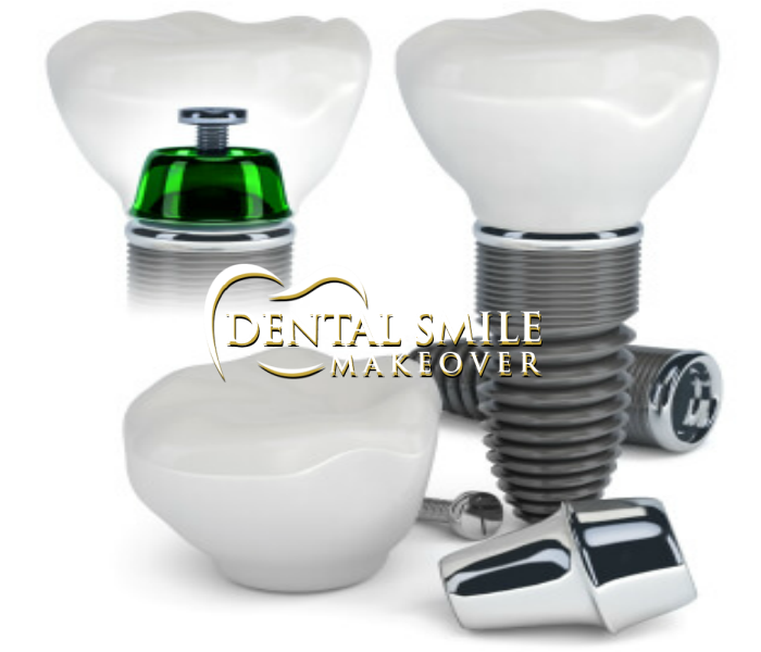 Dental Smile Makeover | 2090 Godby Rd, College Park, GA 30349, USA | Phone: (770) 991-0212