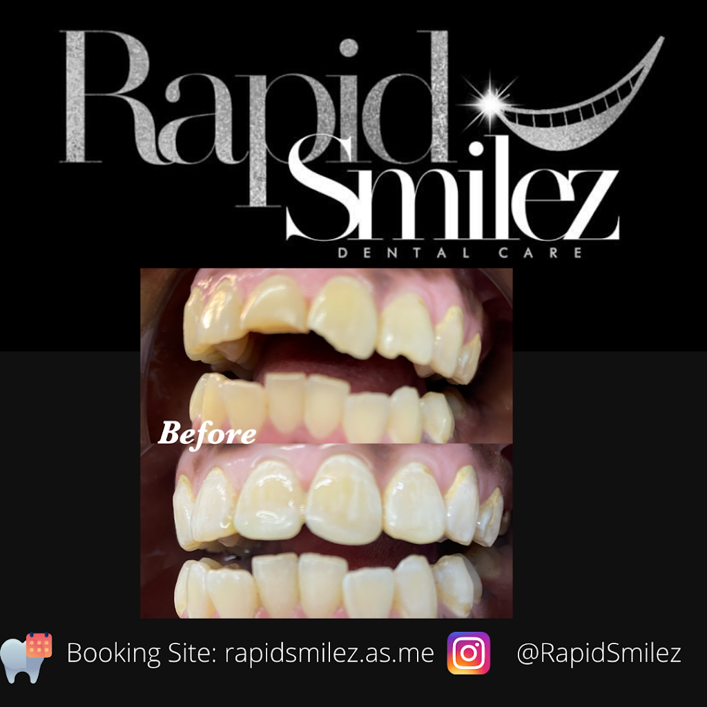 Rapid Smilez | 5611 W Fayetteville Rd #101, Atlanta, GA 30349, USA | Phone: (866) 438-8837