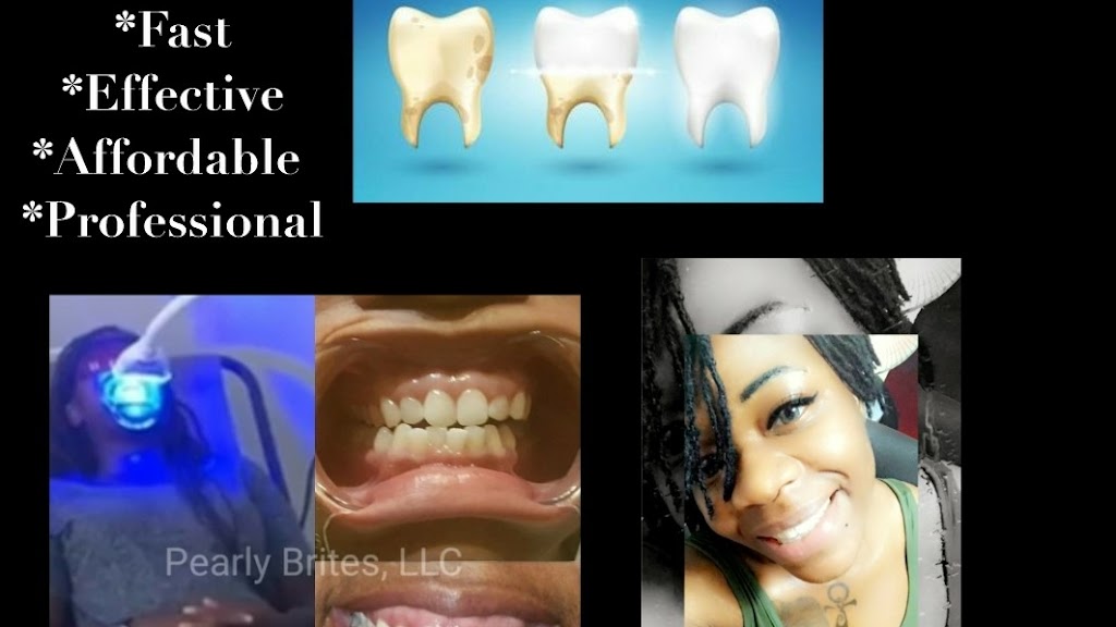 Pearly Brites Teeth Whitening, LLC | 2300 Rittenhouse St, Hyattsville, MD 20782, USA | Phone: (240) 801-3552