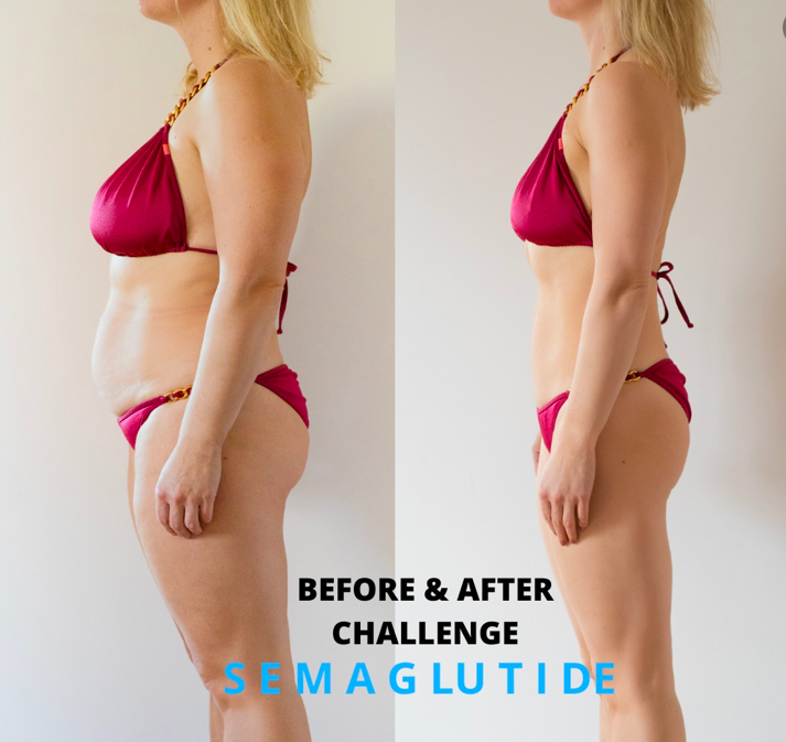www.Semaglutide4Me.com | 10410 Lake Hasson Cir, Clermont, FL 34711, USA | Phone: (855) 932-5038