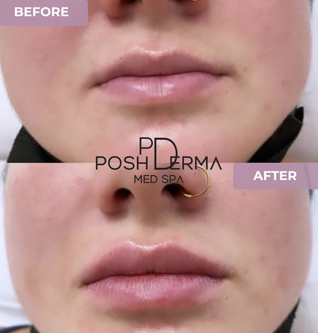 Posh Derma Med Spa | 2231 Central Park Ave, Yonkers, NY 10710, USA | Phone: (914) 639-2424