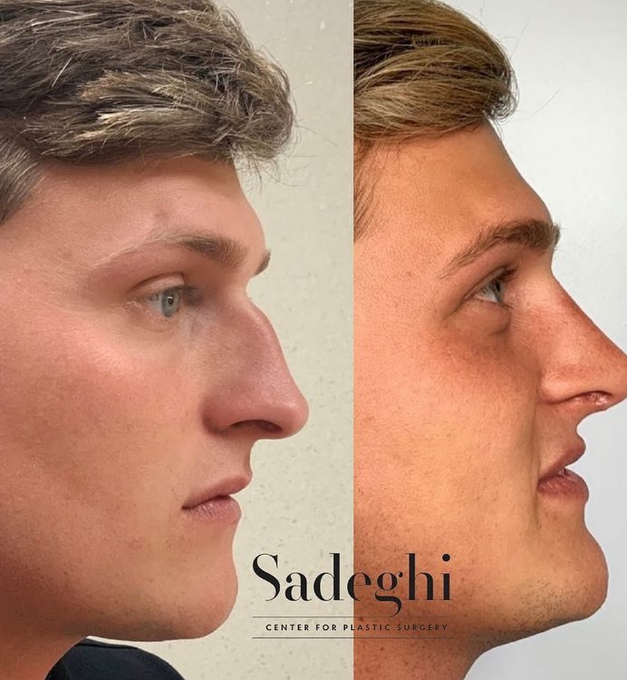 Sadeghi Center for Plastic Surgery | 2551 Metairie Rd Suite 100, Metairie, LA 70001, United States | Phone: (504) 322-7435