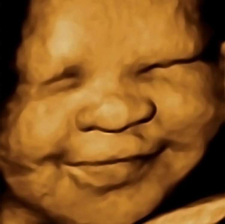 First Impressions 3D St.Louis 3D Ultrasound & Photography | 12 Municipal Dr suite d, Arnold, MO 63010, USA | Phone: (636) 543-4664