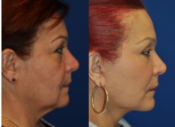 Totonchi Plastic Surgery | 38 Main St #300, Westlake, OH 44145, USA | Phone: (216) 778-2262