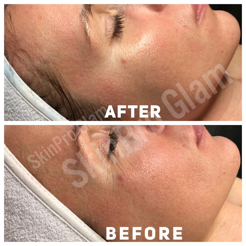 SkinPro Glam | Salon Republic, 303, 39825 Alta Murrieta Dr B-25 Studio, Murrieta, CA 92563, USA | Phone: (951) 395-0838