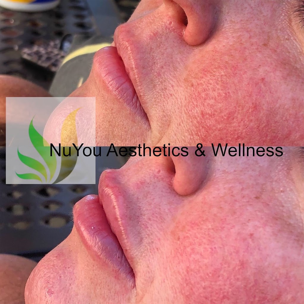 NuYou Aesthetics and Wellness MedSpa | 2721 Fairview Blvd Suite 106, Fairview, TN 37062, USA | Phone: (615) 266-2178