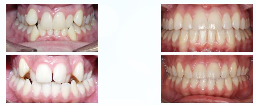 Central Texas Orthodontics - Dr. Brian St.Louis | 3413 W Slaughter Ln, Austin, TX 78748, USA | Phone: (512) 292-1910