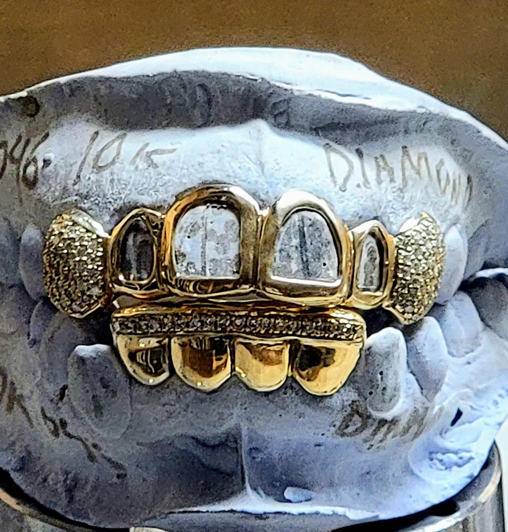 WG Gold Grillz | 10300 SW 72nd St # 280, Miami, FL 33173 | Phone: (786) 712-9299