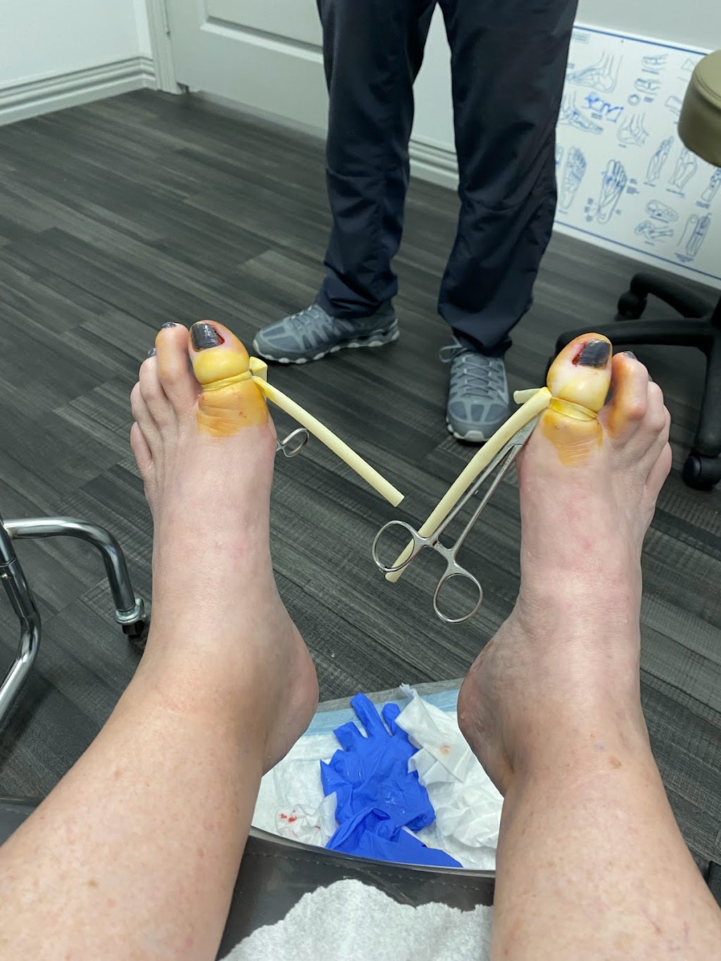Flower Mound Foot and Ankle Center: Tommie Harris, DPM | 4491 Long Prairie Rd Suite 550, Flower Mound, TX 75028, USA | Phone: (972) 200-9823