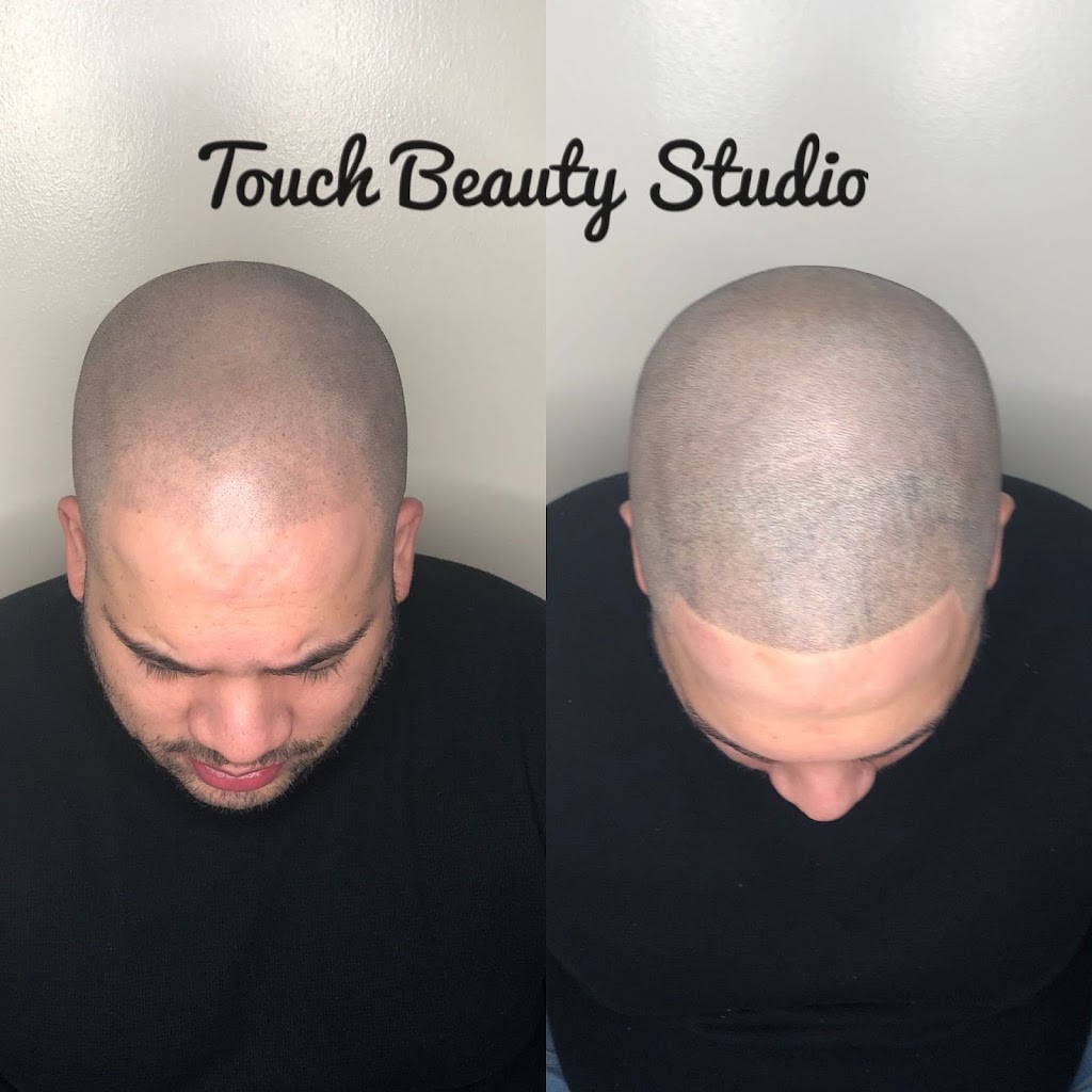 TBS SCALP MICROPIGMENTATION | 304 E 178th St, Bronx, NY 10457, USA | Phone: (646) 655-8483