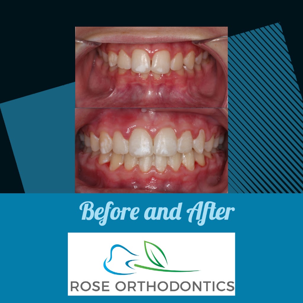 Rose Orthodontics: Aaron Rose, DMD, MS | 980 W Central Ave Suite D, Delaware, OH 43015 | Phone: (740) 272-4455