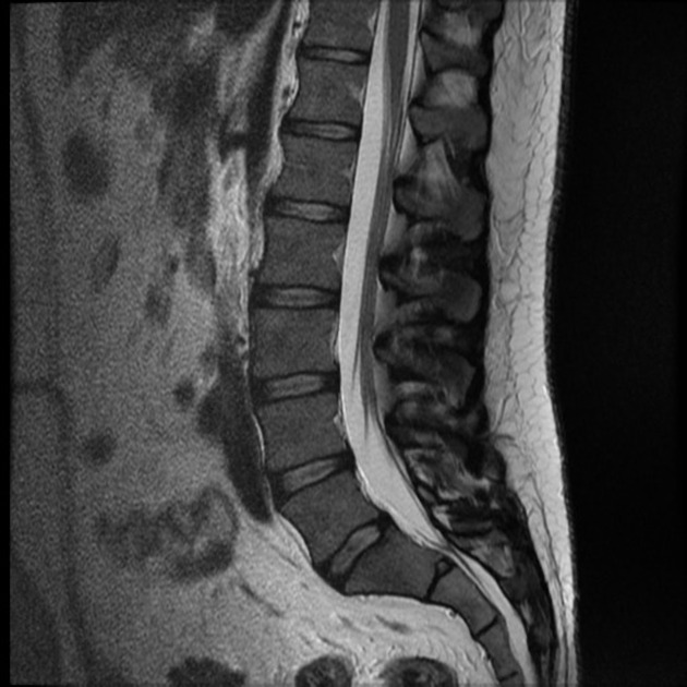 Stanford Medicine Spine Center - Pleasanton | 5725 W Las Positas Blvd Ste 200, Pleasanton, CA 94588, USA | Phone: (925) 272-2860