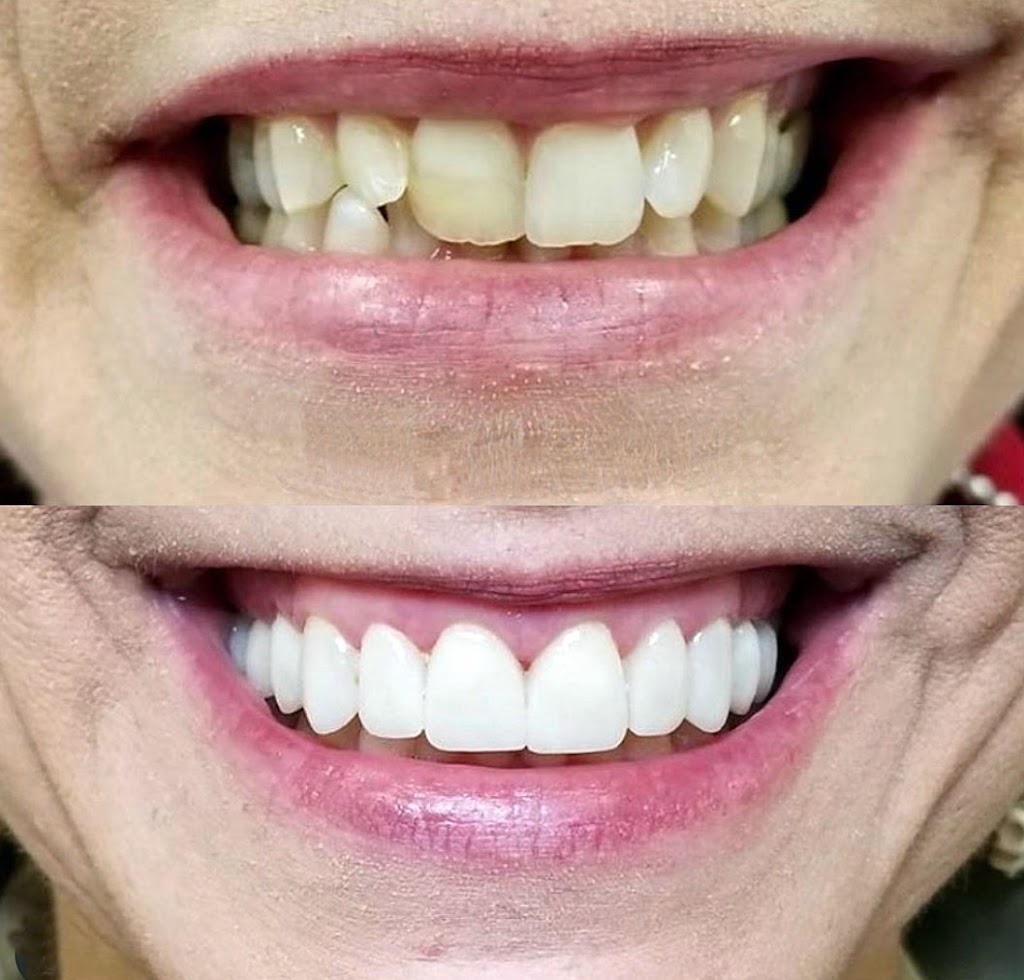 Wow Dental | 18525 Moross Rd, Detroit, MI 48224, USA | Phone: (313) 371-9880