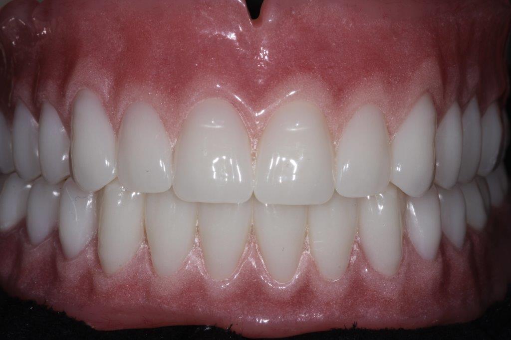 Prairie Fields Dentistry | 16072 Metcalf Ave, Overland Park, KS 66085, USA | Phone: (913) 871-5360