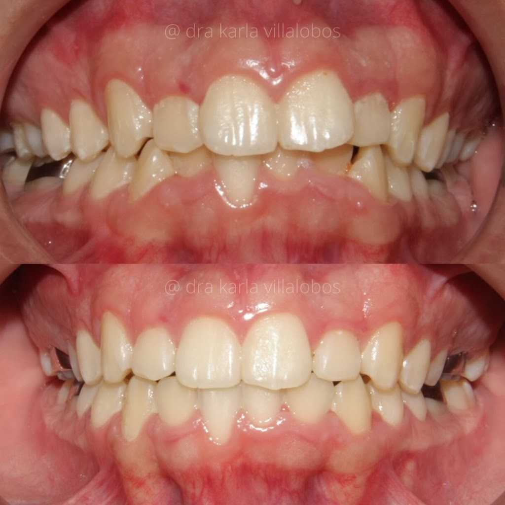 Implantes dentales en Tijuana - DENTOK México | Diego Rivera 2311-Int. 404, Zona Urbana Rio Tijuana, 22010 Tijuana, B.C., Mexico | Phone: 664 630 5194